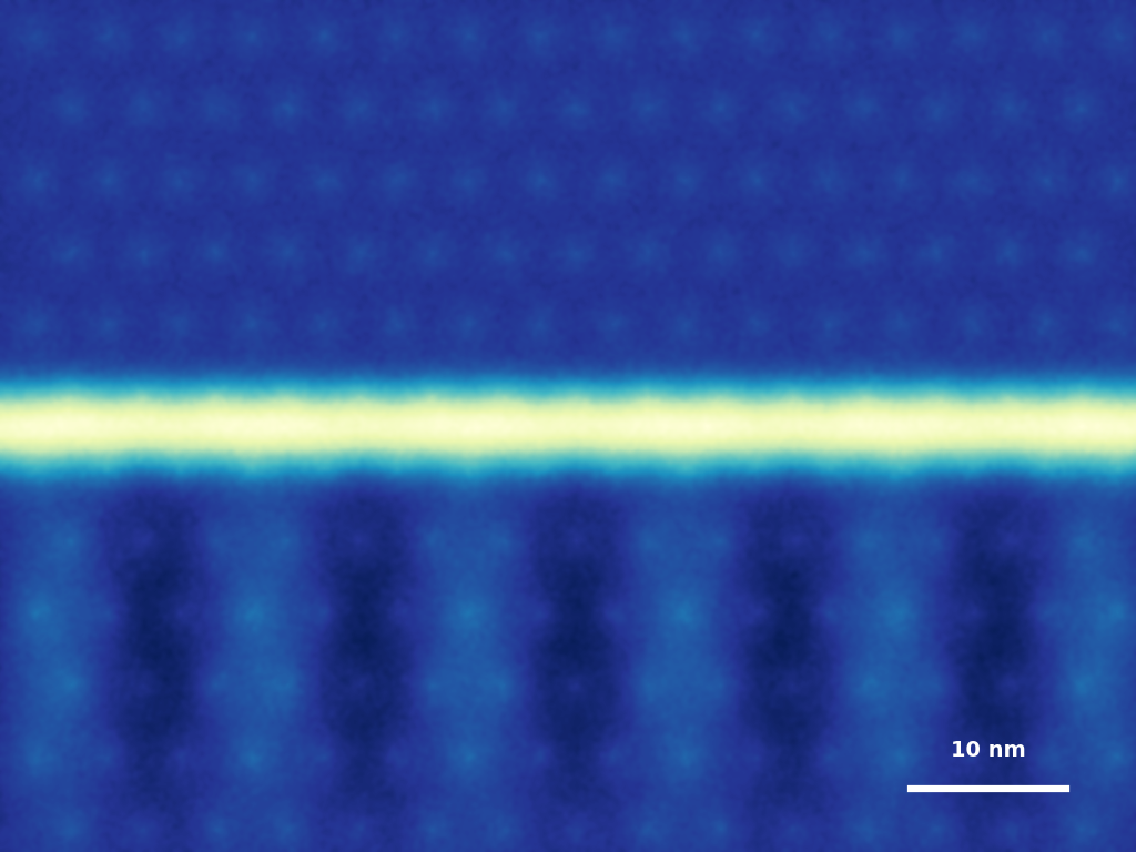 Cryo-EM Nanopore vault membrane separating somatic choice from germline sequence